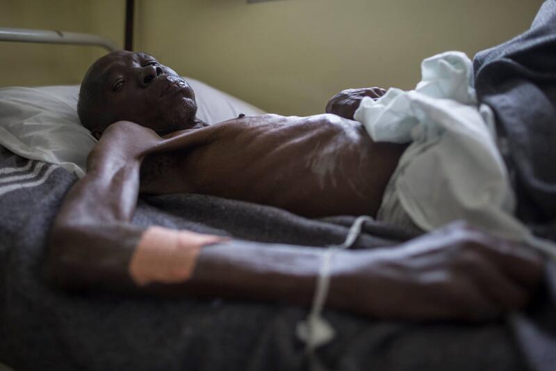 Kinshasa, DRC: A patient* admitted to MSF’s AIDS unit who died of tuberculosis days after this photo was taken