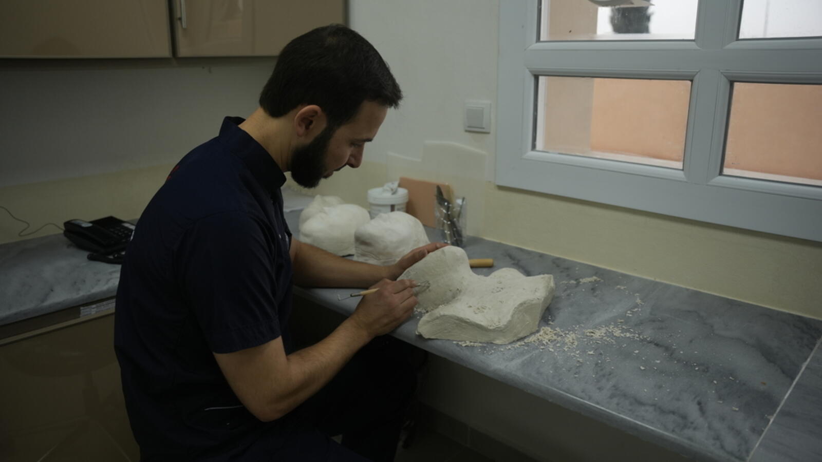 Huge needs for burns patients in Syrian camps